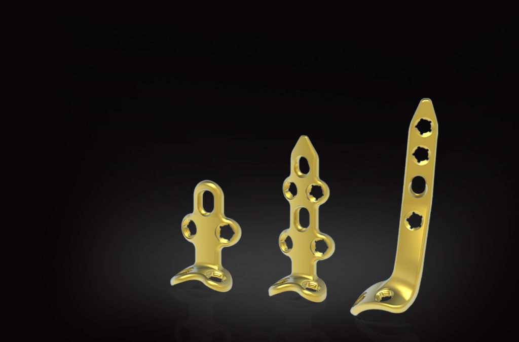 Advita EPIC Extremity Ankle Fusion Plate System