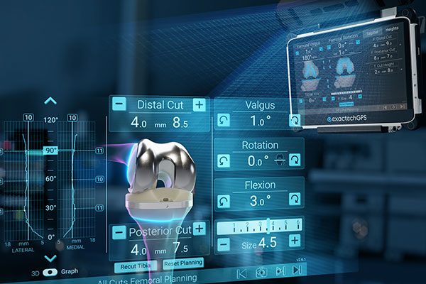 Advita Newton Knee with GPS for Knee Replacement