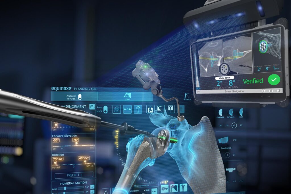 Advita Equinoxe Shoulder with GPS Technology for Shoulder Replacement