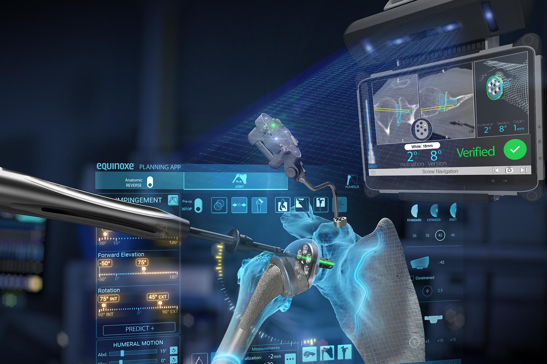 Advita Equinoxe Shoulder with GPS Technology for Shoulder Replacement