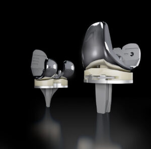 Advita Knee Triverse System