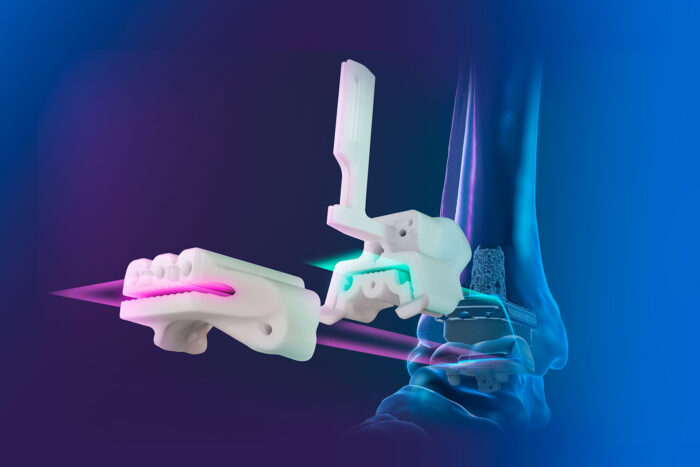 Tibia Press Vantage Ankle 3D & 3D+ Tibias | Advita Ortho