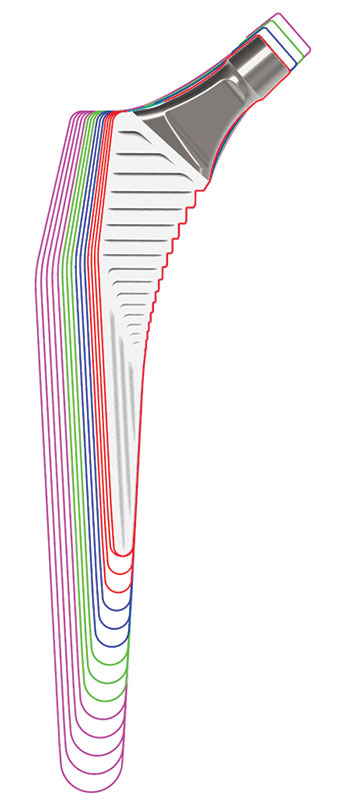 Alteon HA Femoral Stem Four neck length groupings and two offsets provide multiple options to restore patient anatomy without the need for neck modularity.