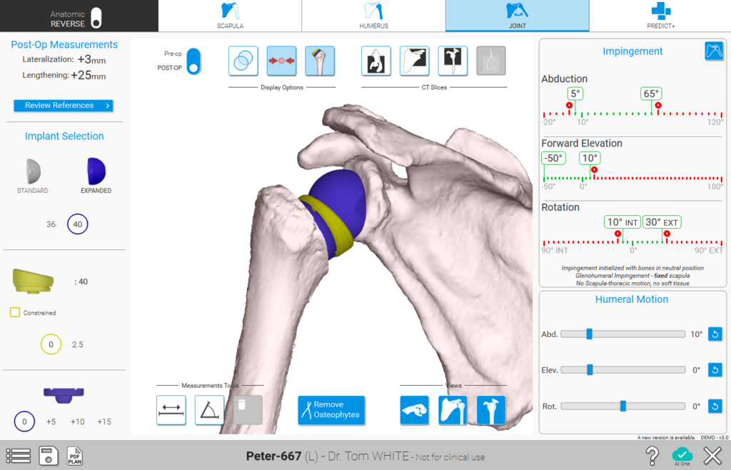 Shoulder Planning App Joint Planning Screen