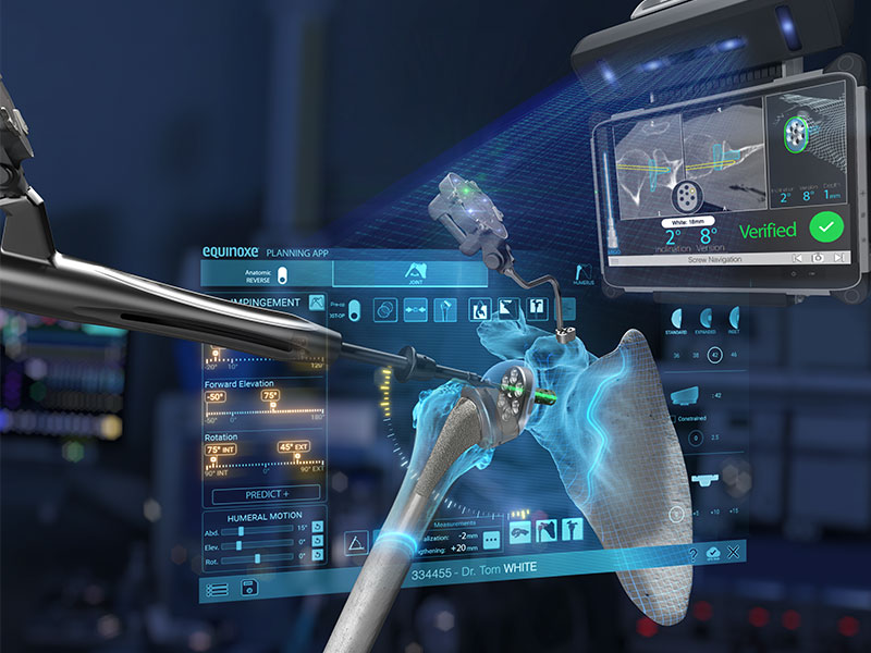 Equinoxe Platform Shoulder System supports Active Intelligence Advanced technology like GPS Shoulder & Shoulder Planning App