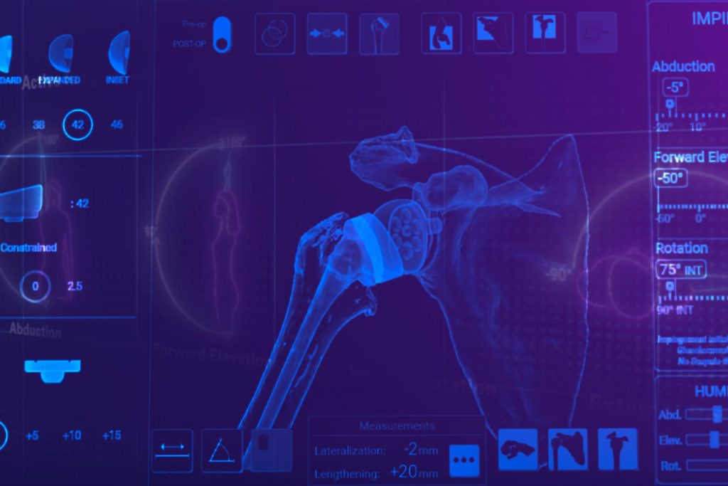 GPS 3D Shoulder Planning Screen