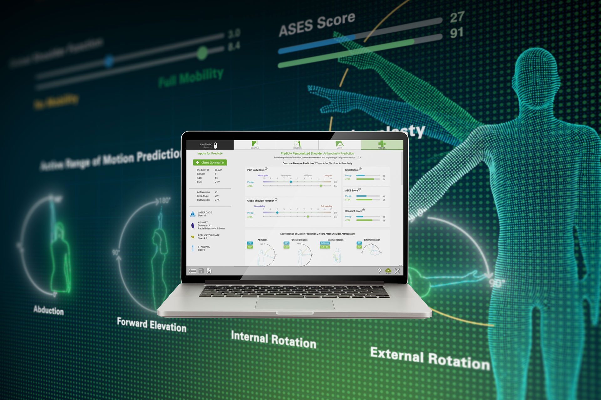 Predict+® Shoulder Outcome Predictor Predict+® is the world’s first clinical decision support tool that leverages predictive analytics and machine learning algorithms