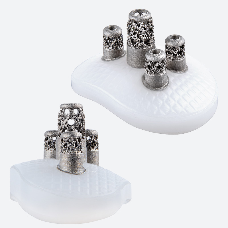 Equinoxe Laser Cage Glenoid