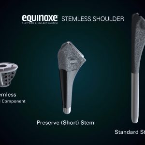 Equinoxe Stemless Shoulder Surgical Animation