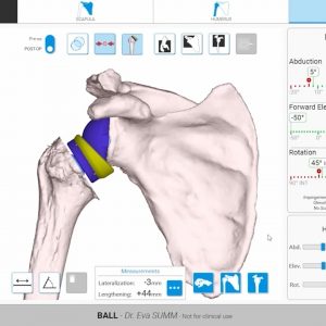 GPS Shoulder Planning App Overview