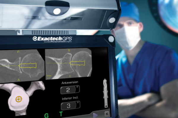 Using GPS to Help with Accurate Glenoid Placement