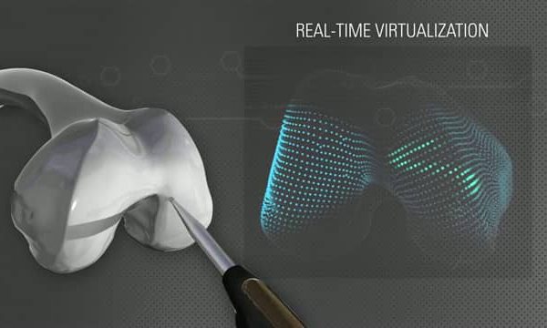 AdvitaGPS Knee used for accuracy and precision