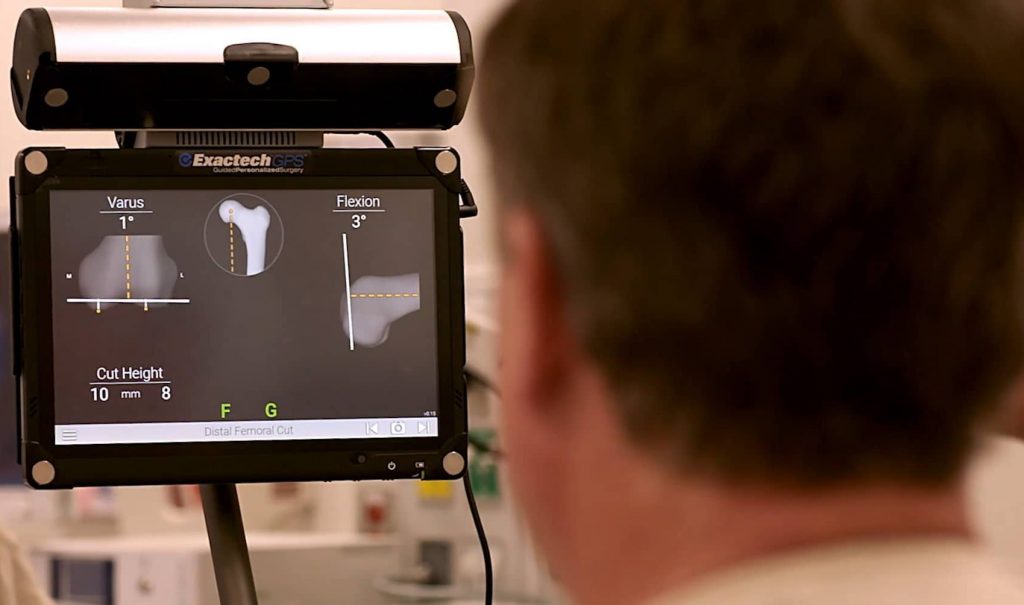 Truliant-Knee-System-Surgeon-AdvitaGPS