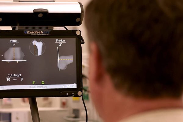 Truliant-Knee-System-Surgeon-AdvitaGPS