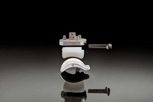 Unique to the Vantage fixed-bearing total ankle system is the locking clip technology that secures the polyethylene to the tibial tray.