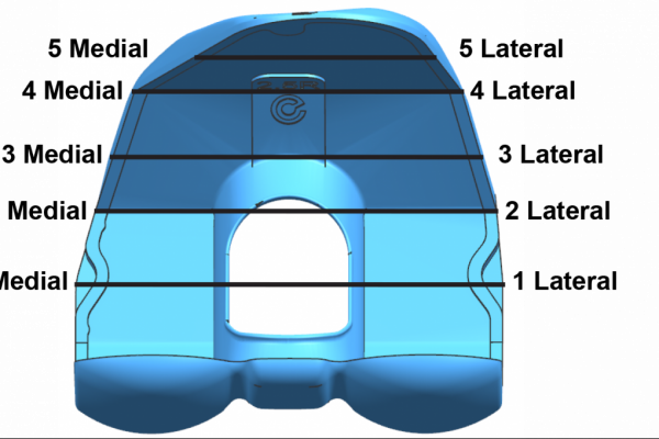 Rendering of Truliant Femoral Component with Lateral and Medial Points