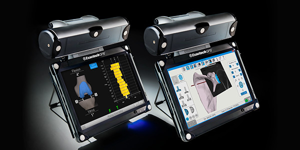 learning how to use computer assisted surgery computer with AdvitaGPS Knee