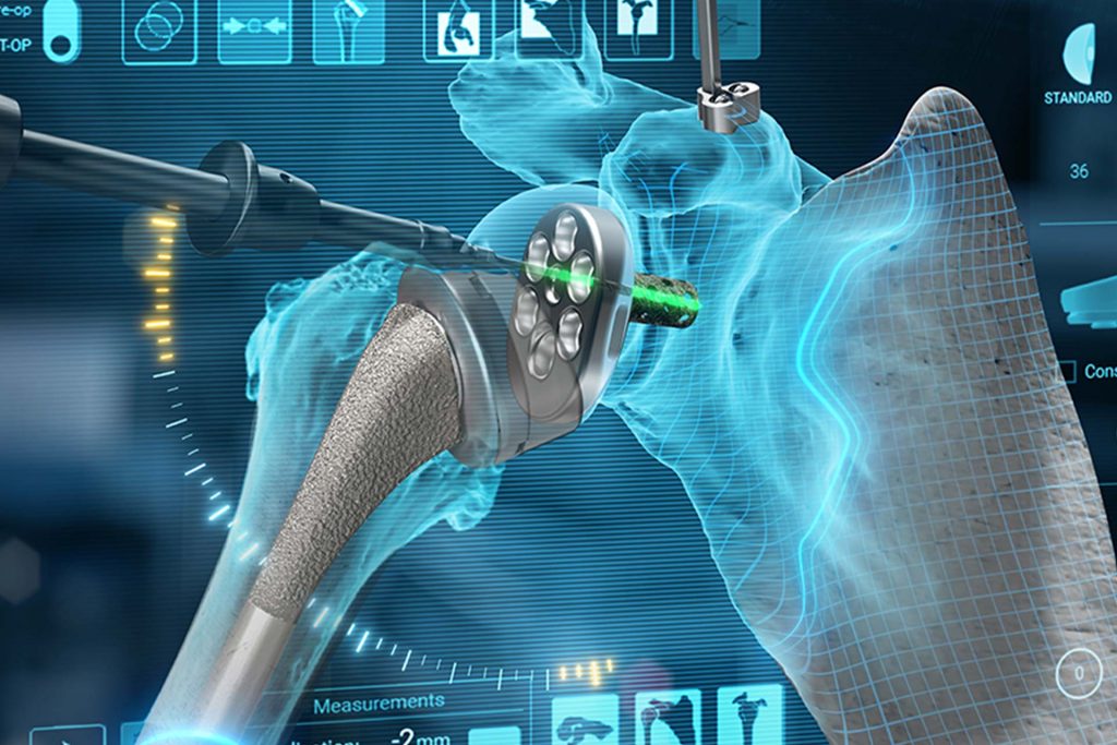 Advita GPS Shoulder and Equinoxe Planning App