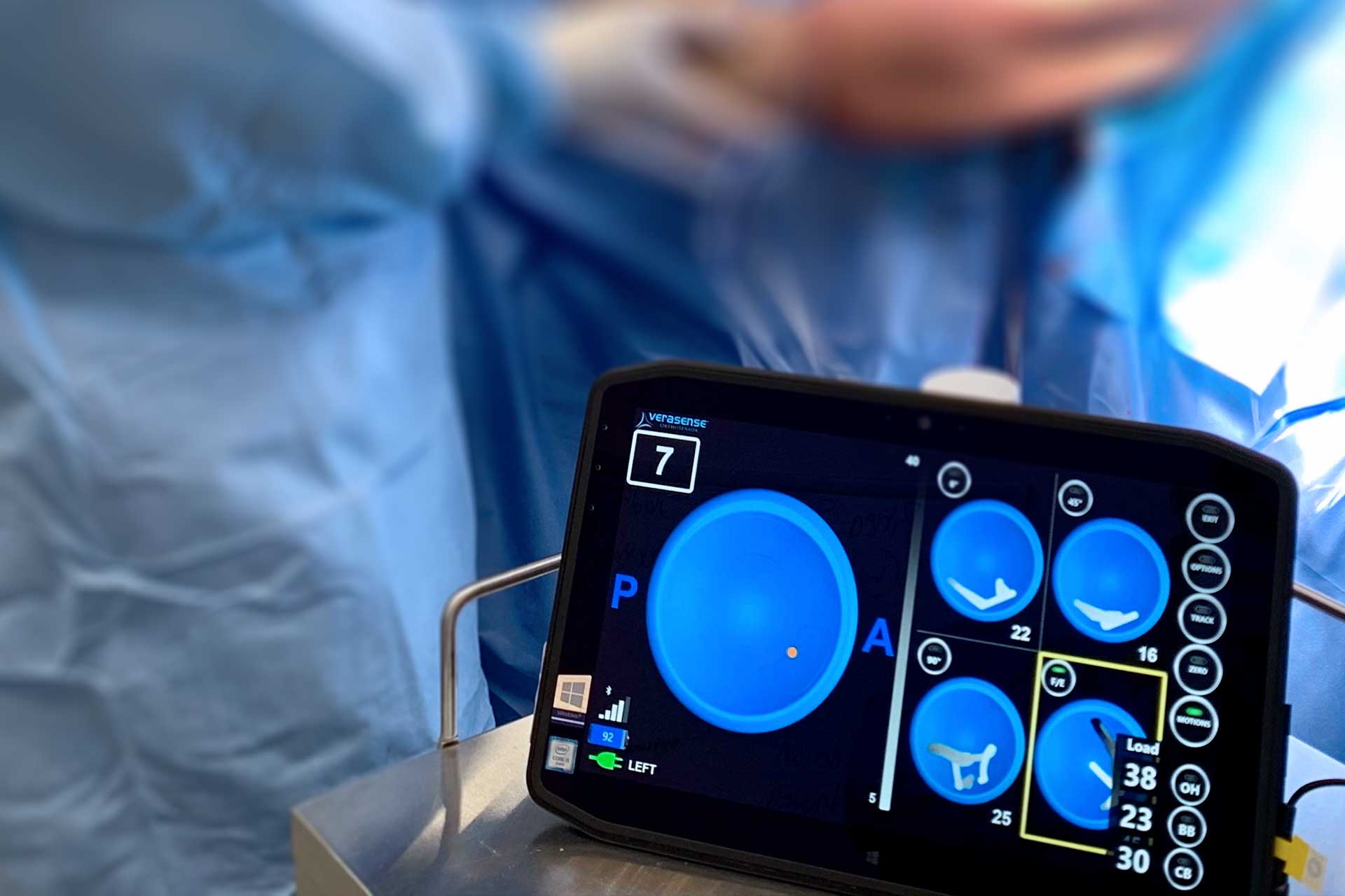 Technology for rTSA