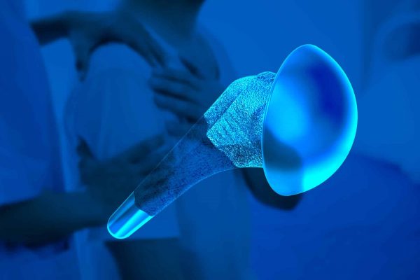 Evaluating Pyrocarbon Shoulder Hemiarthroplasty: Benefits and Drawbacks