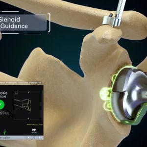 GPS Shoulder Animation: aTSA and rTSA