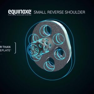 Equinoxe Small Reverse Shoulder Surgical Animation