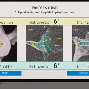 25-0002868_Rev_A_Advita_Ortho_GPS Shoulder Surgery Featuring Ergo GPS Instrumentation