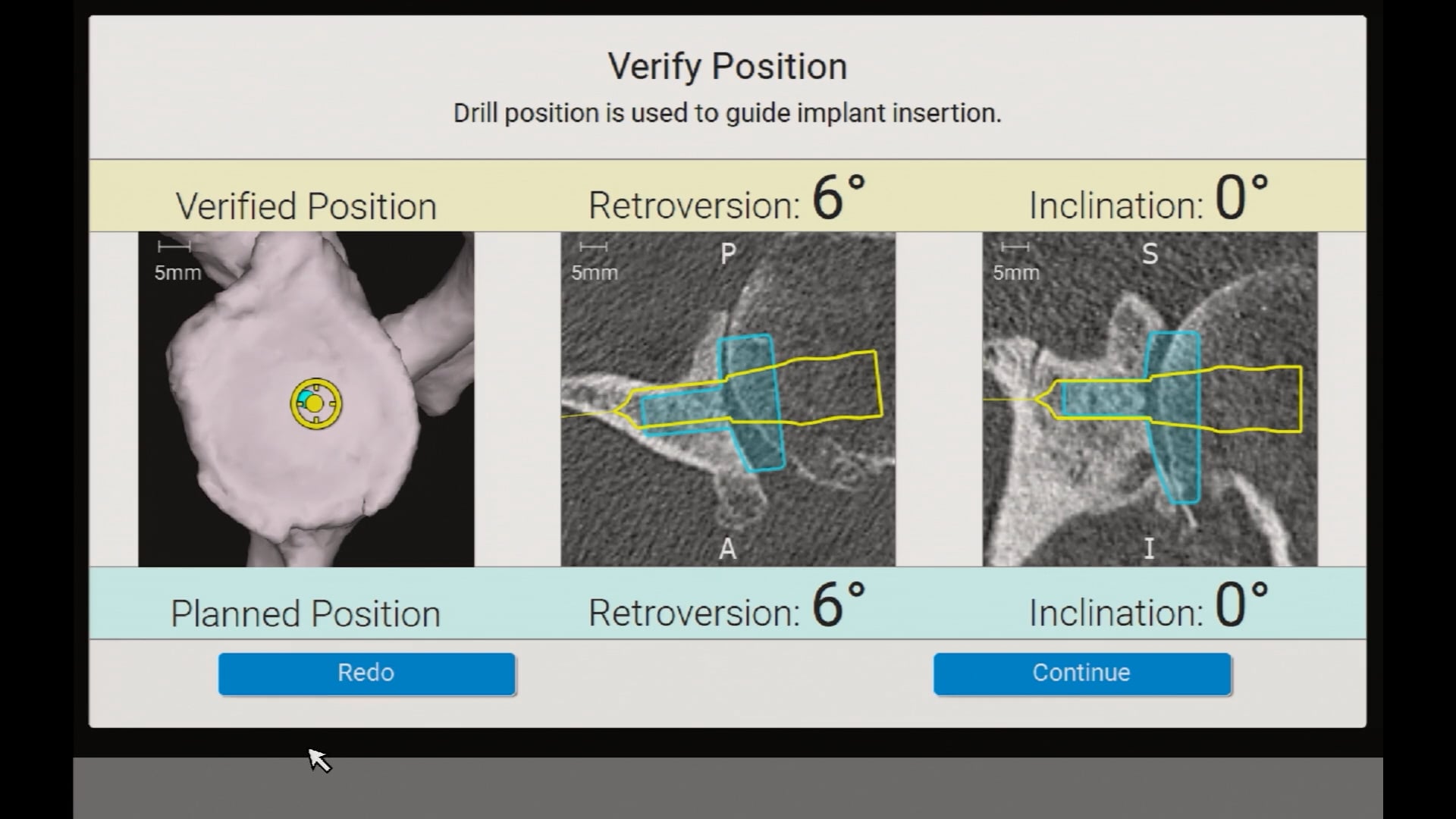 25-0002868_Rev_A_Advita_Ortho_GPS Shoulder Surgery Featuring Ergo GPS Instrumentation