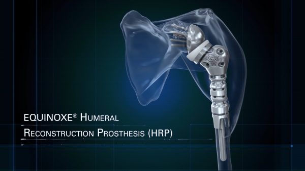 Equinoxe Humeral Reconstruction Prosthesis Overview Animation | Advita ...
