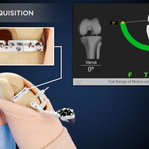 GPS Knee Animation: Newton Balancing Technology