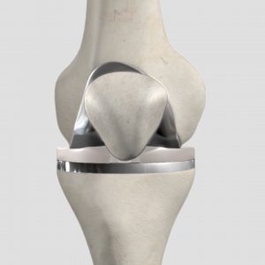 Understanding Total Knee Replacement Surgery Patient Animation