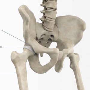Understanding Total Hip Replacement Patient Animation