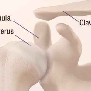 Understanding Primary Shoulder Replacement Patient Animation