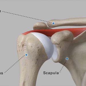 Understanding Reverse Shoulder Replacement Patient Animation