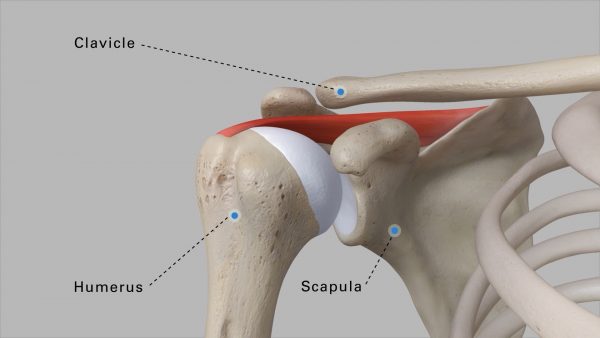 Understanding Reverse Shoulder Replacement Patient Animation | Advita Ortho