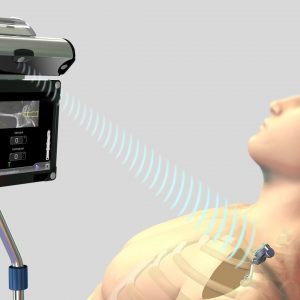 Advita GPS Shoulder Patient Animation