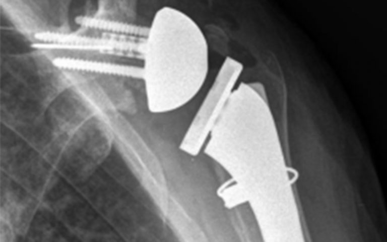 Innovations | Can Sufficient Internal Rotation Be Achieved With ...