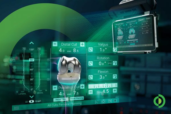 Advita Ortho Wins Innovation Award for its Newton Balancing Technology for Knee Replacement Surgery GPS Newton Illustration