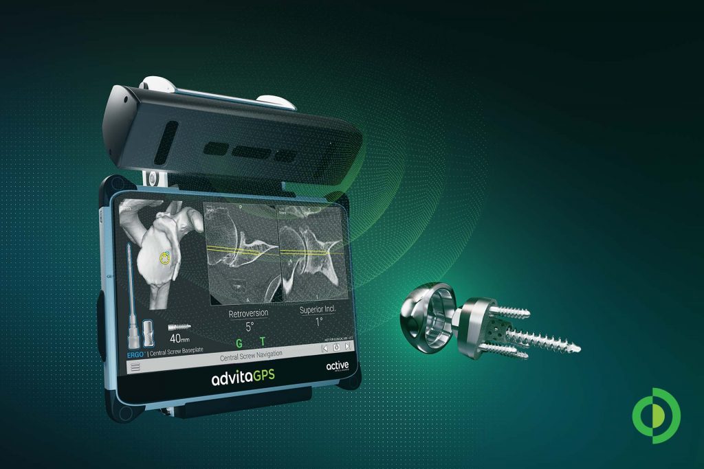 Advita Ortho Announces First GPS-Guided Shoulder Case with Central Screw Baseplate