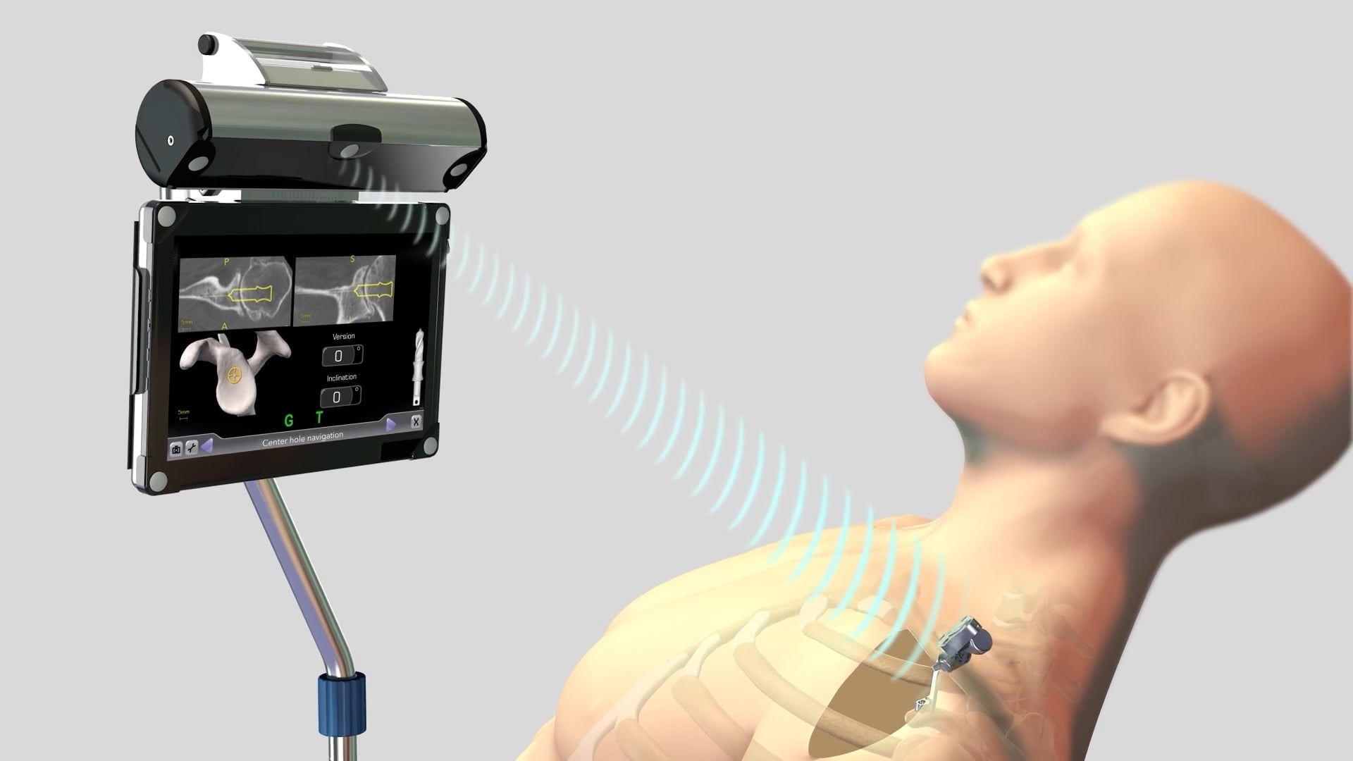 Advita GPS Shoulder Patient Animation