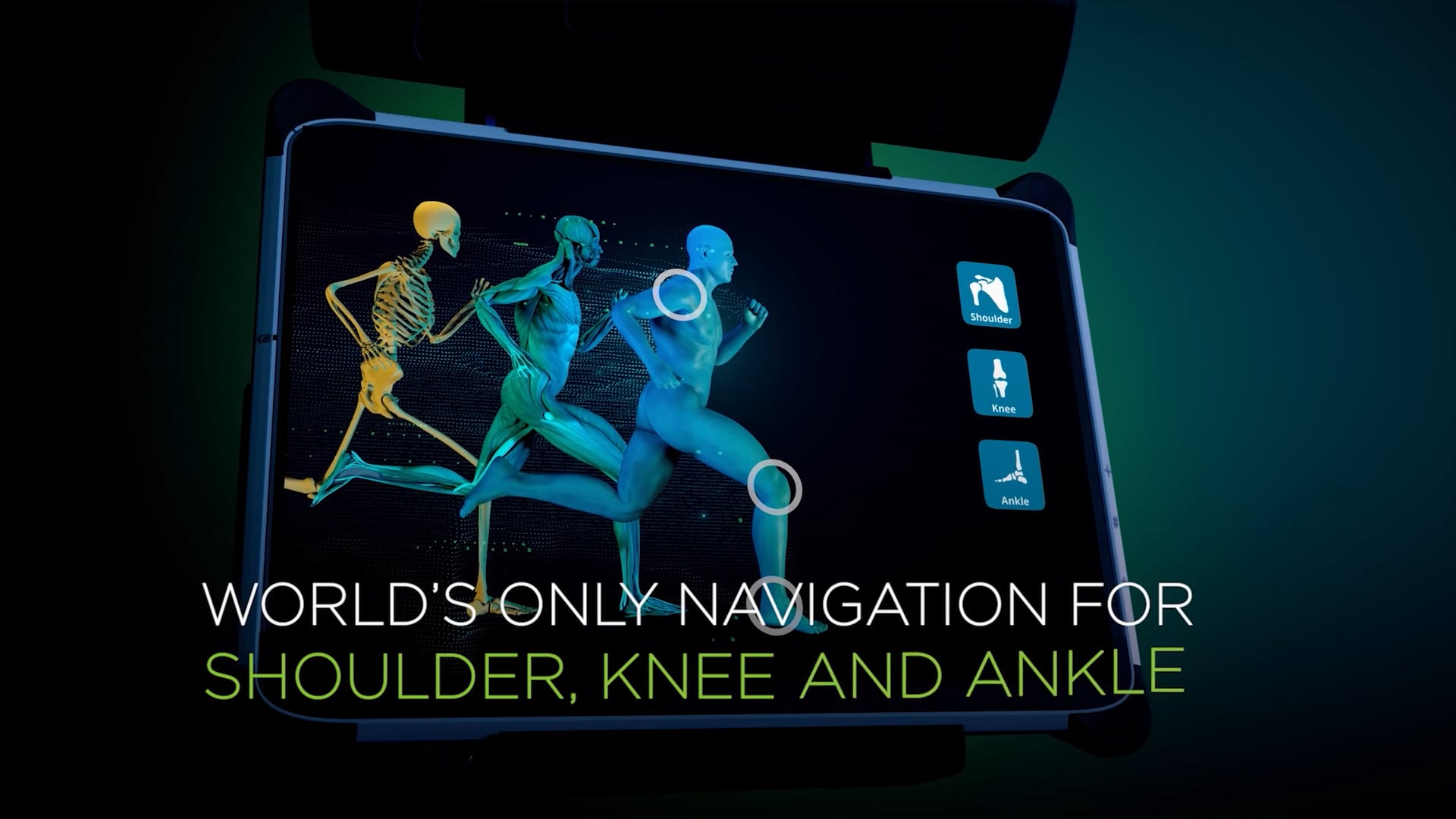 Advita GPS navigation system for knee, shoulder and ankle replacement