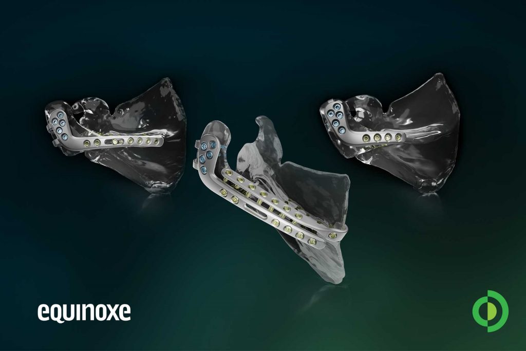 Advita Ortho Announces First Clinical Use of Equinoxe Shoulder Scapula Reconstruction System