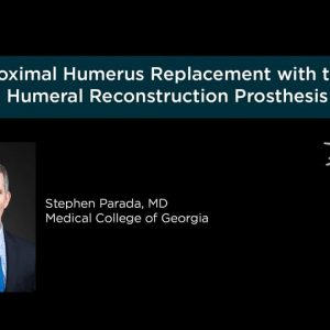Proximal Humerus Replacement with the Equinoxe Humeral Reconstruction Prosthesis