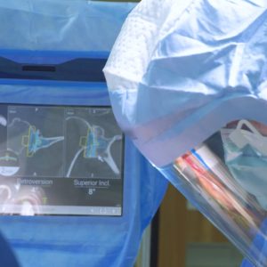 Shoulder Arthroplasty Navigation System | Guided by What Matters: Advita GPS™