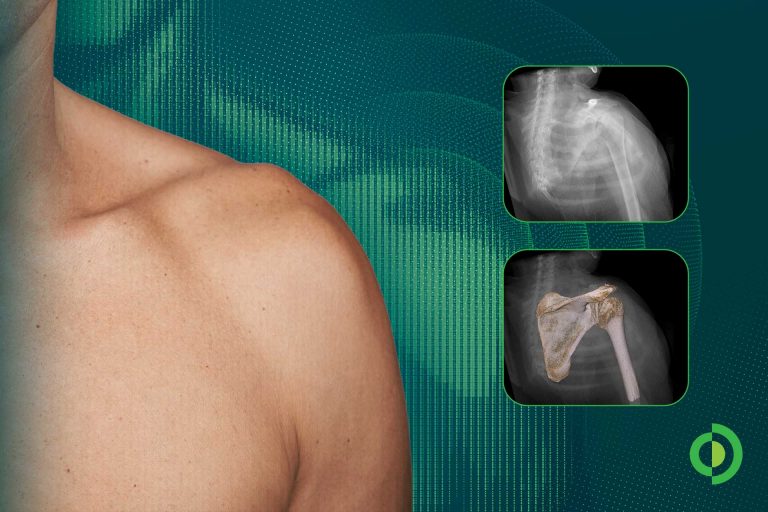 Advita Ortho Highlights New Research on AI-Generated Shoulder Digital Twins and Surgical Navigation at CAOS 2026