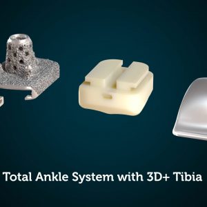 Vantage Total Ankle System with the Vantage Ankle 3D+ Tibia Surgical Animation