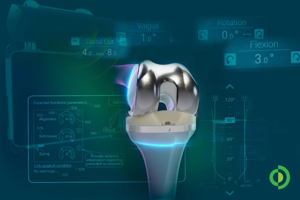 Advita Ortho GPS Newton knee balancing technology