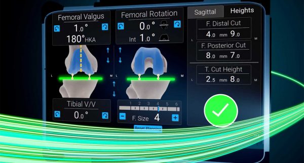 Advita Ortho Expands Scientific Evidence Advancing the Future of Balancing (OR Predictive Planning) for Total Knee Replacement Surgery Advita GPS Knee Screen
