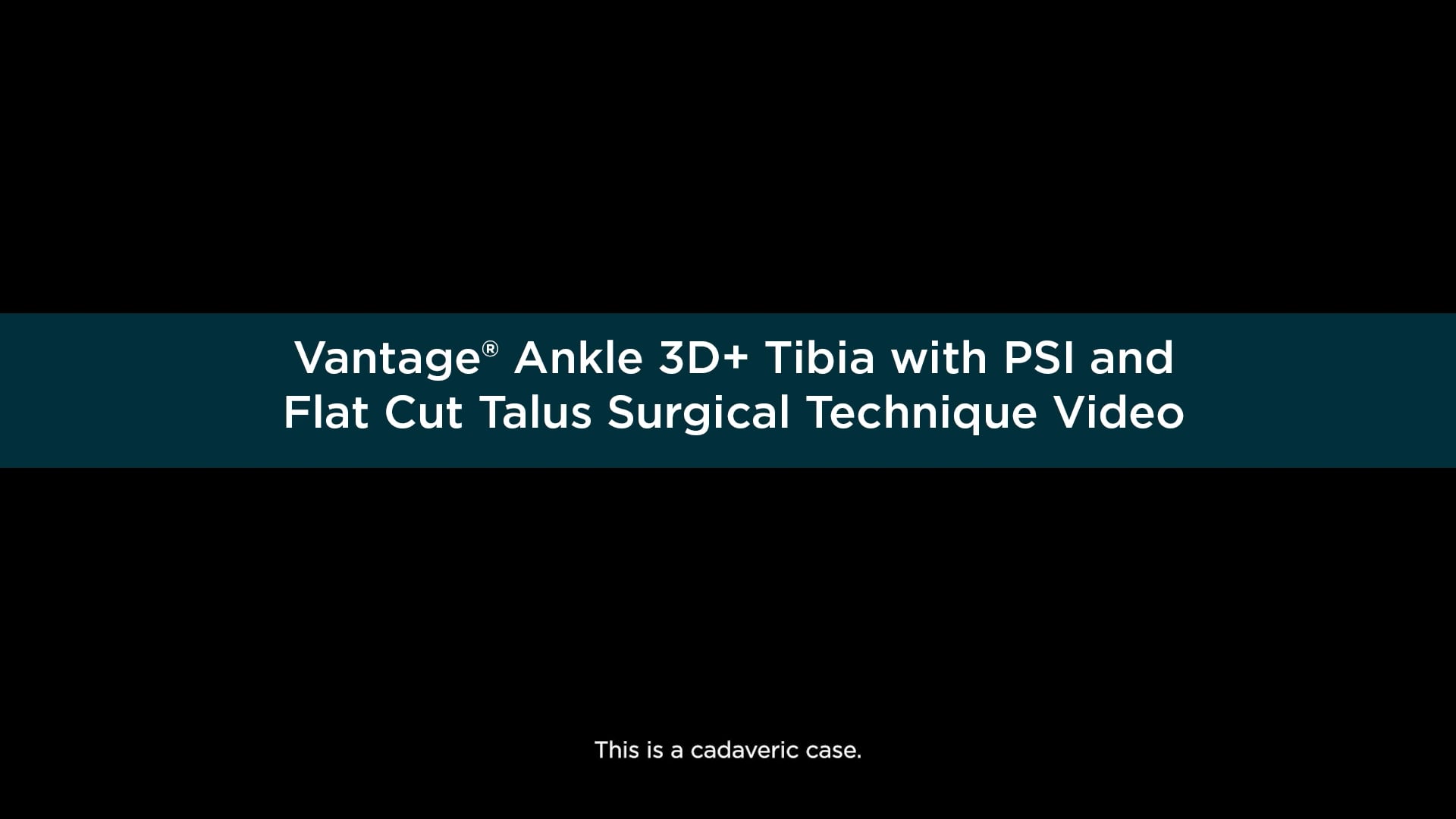 25-0005932 Rev A Vantage Ankle 3D+ Tibia with PSI and Flat Cut Talus Surgical Technique Video