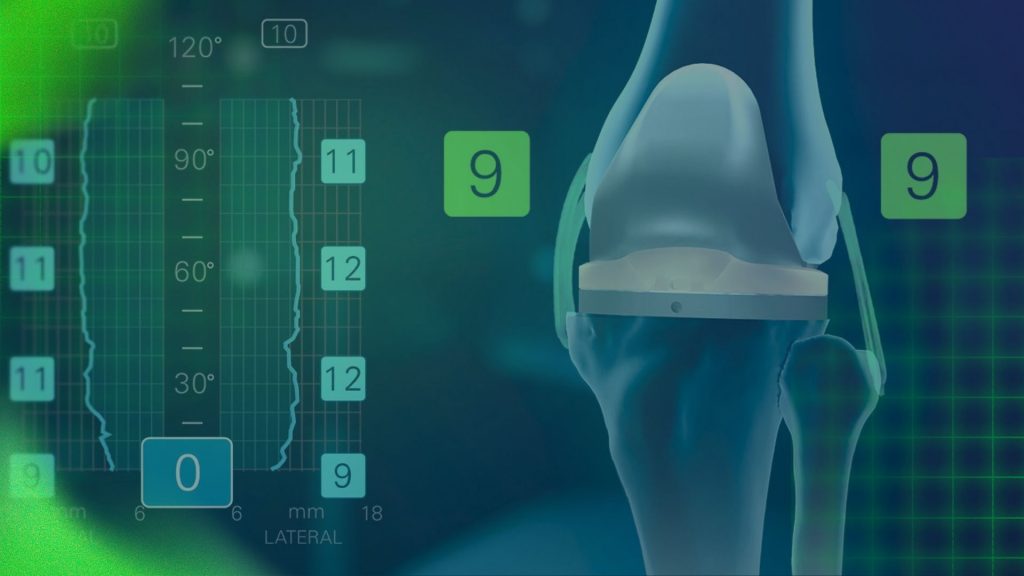 Beyond Precision: Advancing Personalized Total Joint Surgery